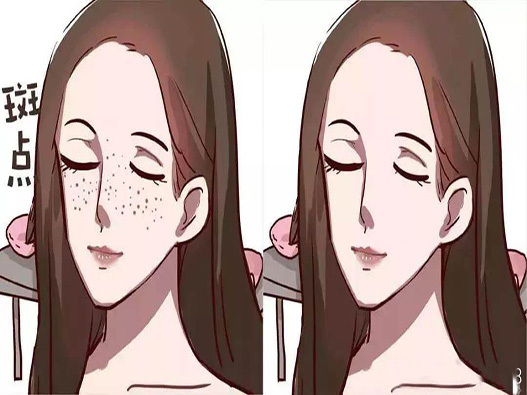 祛斑療程商標注冊哪一類?