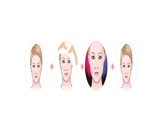 去痘療程商標注冊哪一類?