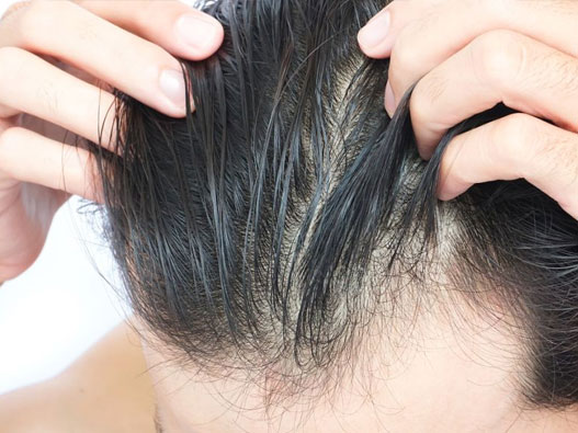 生發油商標注冊哪一類？